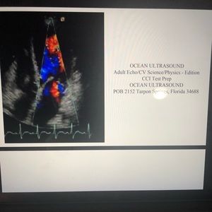 CCI ARDMS ECHO BOARD EXAM ONLINE FLASHCARDS